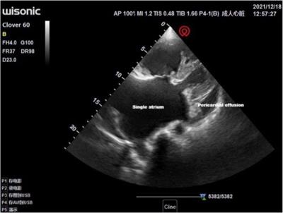 Case report: Successful anesthesia management of noncardiac surgery in a patient with single atrium